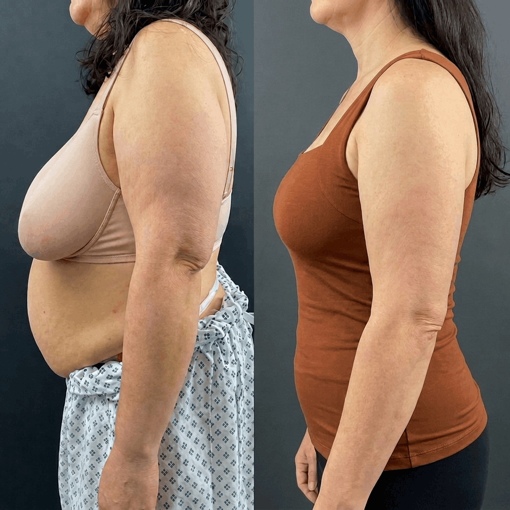 👵Solaroza® Built-In Bra Shaping Camisole – Seamless Comfort & Sculpting Support