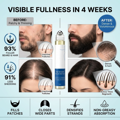💎Advanced Hair Growth Roll-On Serum | 3% Rosemary | 2% Aminexil | 3% Redensy l 2% Anagain | Precision Scalp Applicator | Paraben & Sulphate Free | Non oily and mess free